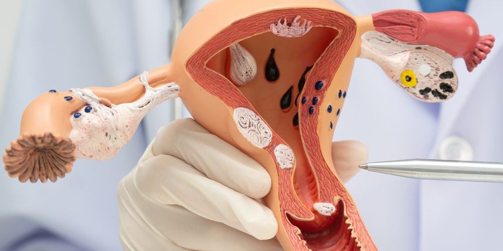 Consulta de ginecología en Puerto Escondido Ixhuá