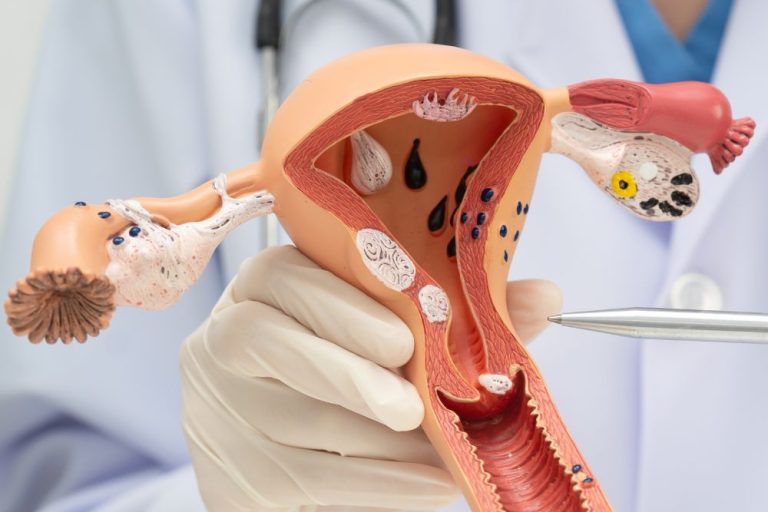 Consulta de ginecología en Puerto Escondido Ixhuá